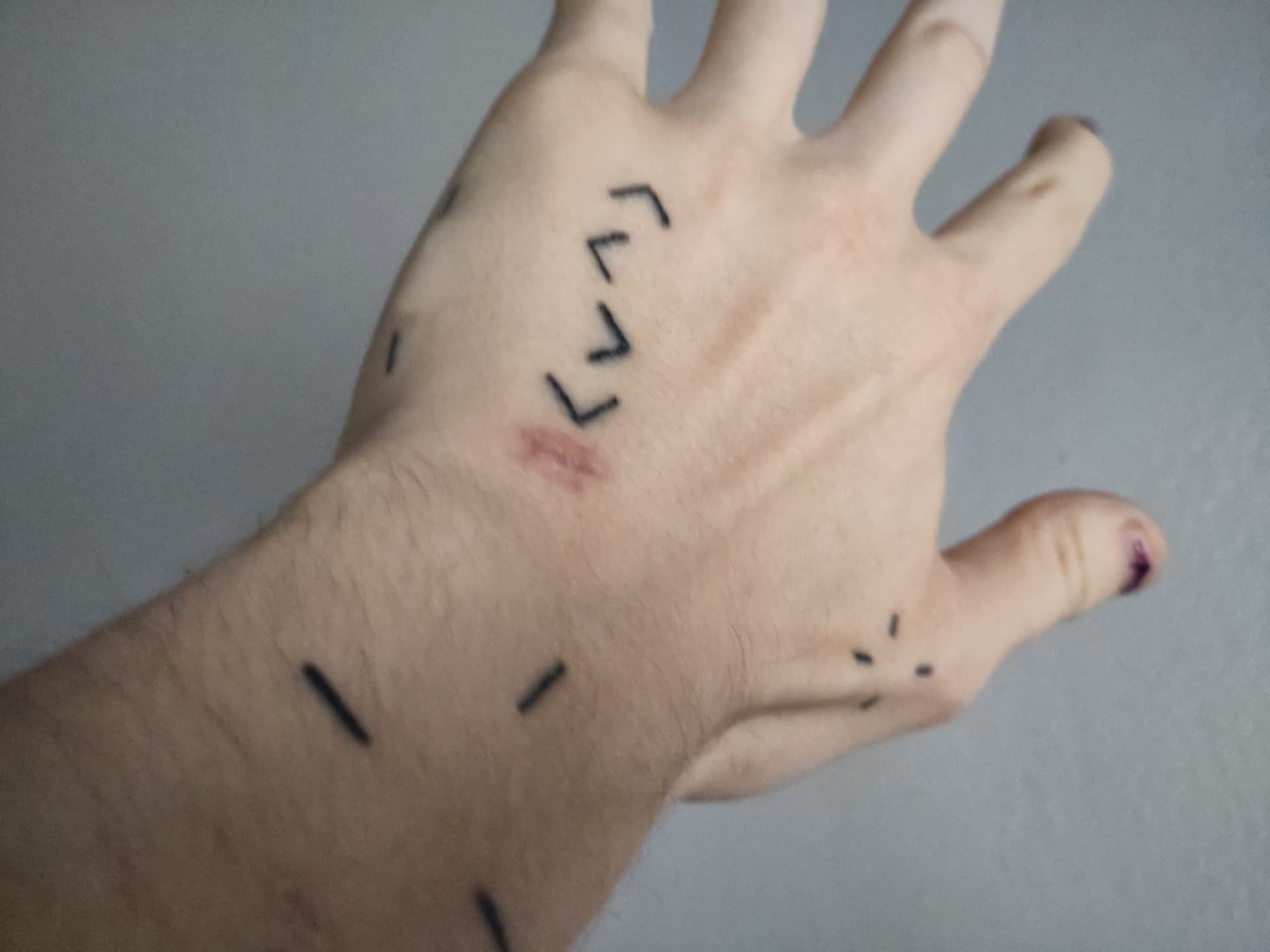 Vvn's hand with linework tattoos, highlighting one in a DDR-like arrow design
